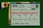 320*240 FSTN Modulo LCD Monocromo per la scansione medica positivo
